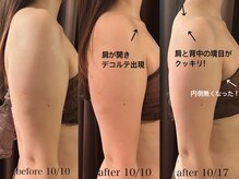 シャングリラ(Shangri-La)/姿勢矯正×キャビ&ハイパー