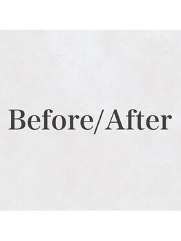 ルピナス バイ ワンズ 海老名店(Lupines by ONE'S)/Before/After［海老名/相模線］