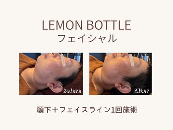 ビーモア(B.MORE)/初回から実感する変化