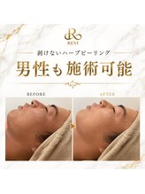 アンフィア(Anfia)/
