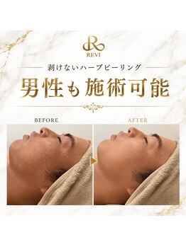 アンフィア(Anfia)/