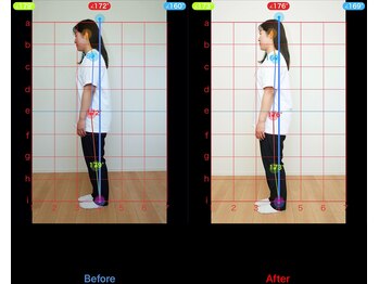 トータルボディケアサロン ふく 江別店の写真/《本格骨格矯正が3980円から受けられる☆》何度も繰り返す症状に!その場しのぎの施術を卒業しませんか?