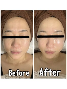 ブランシュール/ハイドラ×エンビロン