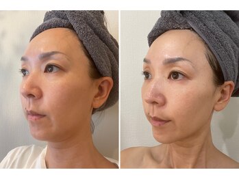 テン エイト(10 8)/ひとまわり小さく!