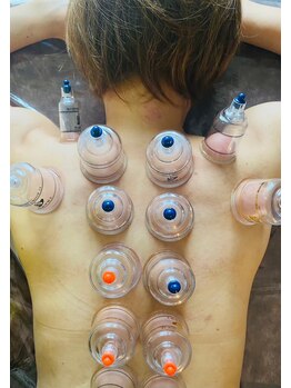 リベル(Liber)/カッピング効果