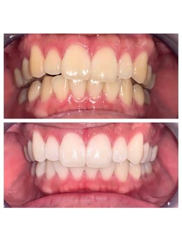 ライトビューティー 池袋店(LightBeauty)/症例写真