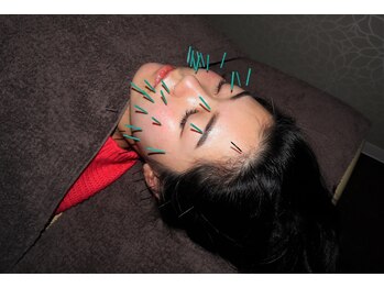 スカイ 鍼灸整骨院 整体院(SKY)/美容鍼