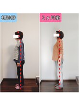 エンビジョン(ENVISION)/before→after