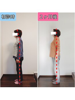 エンビジョン(ENVISION)/before→after