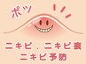 【ニキビ改善】1年以上繰り返しているニキビに専用クーポン90分￥6,800