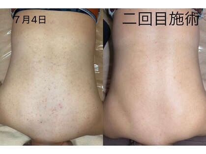 ウィズサロン(withサロン)の写真