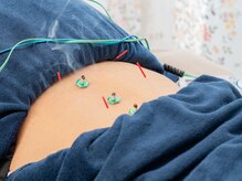 ドマイロ鍼灸院(Domairo鍼灸院)の雰囲気(身体の冷えにはお灸がピッタリ!芯から温めていきましょう♪)