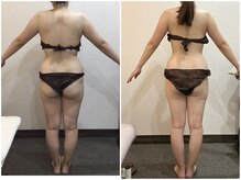 美容整体ウェリナ 中川八田院/小顔矯正/骨盤矯正/美脚サロン