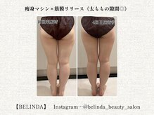 ベリンダ 中崎町店(BELINDA)/【痩身マシン×筋膜リリース】