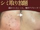 ベルフィーヌ ノーブル(BELLEFINE noble)の写真