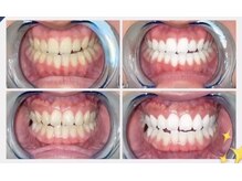 ホワイトニングビューティー 名古屋栄店(WHITENING BEAUTY)/セルフホワイトニング
