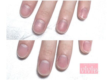 ネイルサロン ビビッド(Nail Salon ViViD)の写真