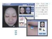 花銀クラブ(花銀Club)/肌診断機　スキンチェッカー