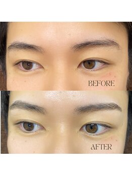 アモール 丸亀店(Amor)/眉毛/まつげパーマ/毛穴/脱毛