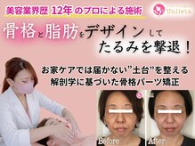 アンリエッタ(Unlieta)