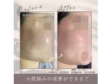 モアトゥインクル 福山宮通り店(MORE twinkle)