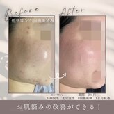 モアトゥインクル 福山宮通り店(MORE twinkle)