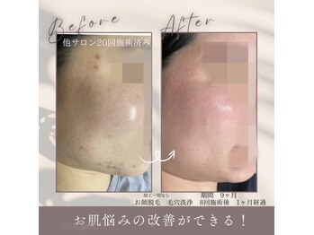 モアトゥインクル 福山宮通り店(MORE twinkle)