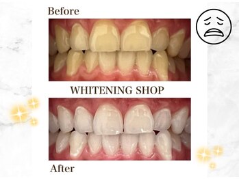 ホワイトニングショップ 守口店