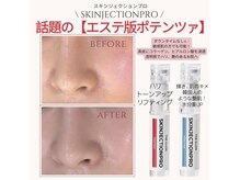 エイミー 名古屋駅前店(eimy.)の雰囲気（NEW！iLLONの『スキンジェクションプロ』ポテンツァと同じ効果）