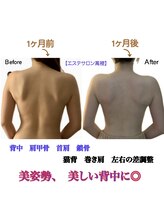 萬裡(マリン)/猫背、巻き肩、左右の差調整