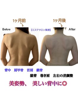 萬裡(マリン)/猫背、巻き肩、左右の差調整