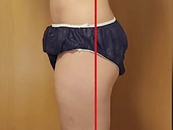 セオリー(Theory)の写真/頑固な凹凸脂肪ケアには《ラジオシェイパー》で撃退！硬い脂肪を柔らかくしむくみケアと太りにくい身体へ◆
