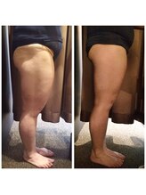 骨盤ストレッチ整体 b/矯正＋ハイパーナイフ