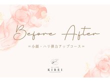 キレイ(KIREI)/ビフォーアフター