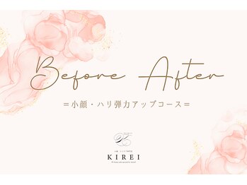 キレイ(KIREI)/ビフォーアフター