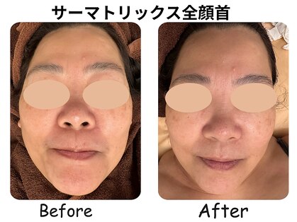 ラディアント たまプラーザの写真