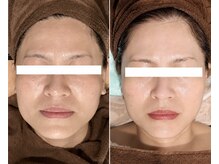 サロン ド メタセコイア(salon de Metasequoia)の雰囲気（【50代女性/施術6回】お肌のお悩み、ご相談ください♪）