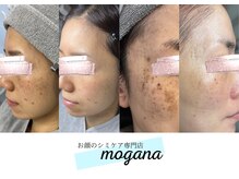 モガナ(mogana)