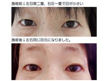 アロマスイーツ(AromaSweets)/まつげパーマ/まつ毛パーマ