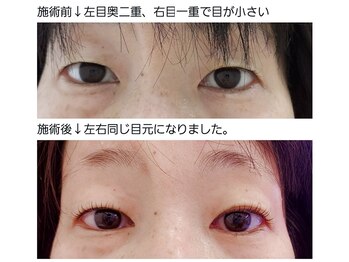 アロマスイーツ(AromaSweets)/まつげパーマ/まつ毛パーマ