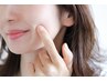 【全顔シュガーリング脱毛】その毛穴、毛です！ツルツルたまご肌★