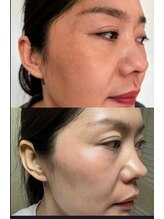 ユミサロン(U Mi Salon)/