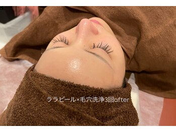 ライフ美容整体院 恵比寿(Life美容整体院)/ララピール×毛穴洗浄