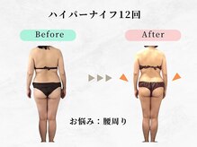 ウェリナ 一宮院/小顔矯正/骨盤矯正/痩身整体