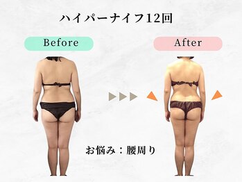 ウェリナ 一宮院/小顔矯正/骨盤矯正/痩身整体