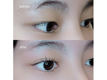 アイラブ(eye love)/