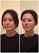 あかり鍼灸 接骨院プラス 南草津院(あかり鍼灸 接骨院PLUS)