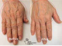 リエル(RIELE)/どんどん綺麗に