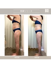 カリスボーテ 関本店/筋膜リリース