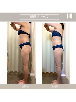 カリスボーテ 関本店/筋膜リリース